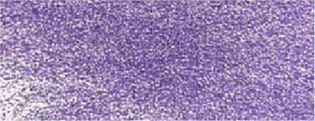 ACID PURPLE (112)